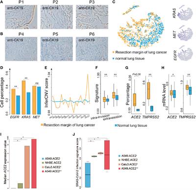 High Expression of ACE2 and TMPRSS2 at the Resection Margin Makes Lung Cancer Survivors Susceptible to SARS-CoV-2 With Unfavorable Prognosis